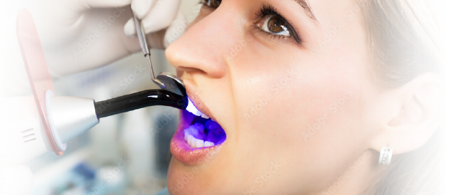 restrotive dentistry at westpoint dental clinic